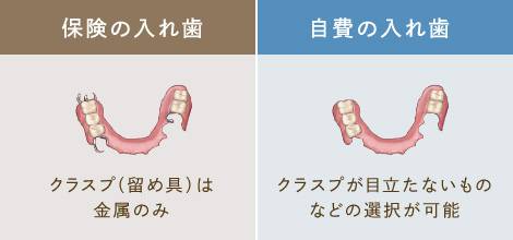 1〜数本の歯を失った場合